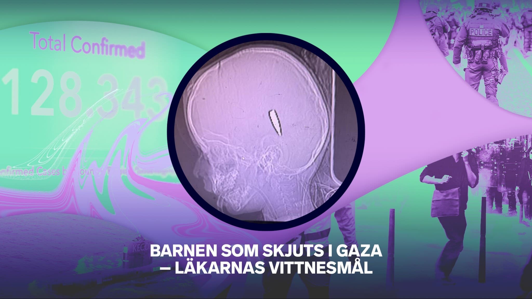 En röntgenbild av ett barns huvud.