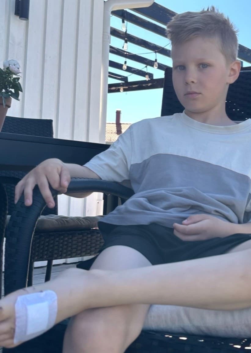 Åttaårige Rikard Pakkala sitter på en stol med bandagerad fot efter att ha blivit attackerad av en gädda under ett sommarbad i Stöckjön utanför Umeå. Närbild visar skador på hans fot.