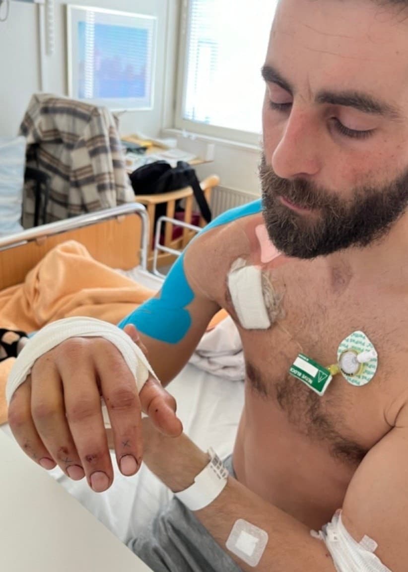 Delad bild. Till vänster syns Joel utomhus i en blå och gul tröja. Till höger syns Joel med bandage och medicinsk utrustning på överkroppen i en sjukhussäng efter handkirurgi.